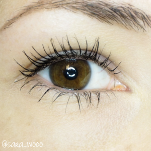 Was ist Wimpernkranzverdichtung